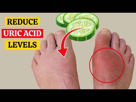 Foods That Lower Uric Acid for Better Health and Wellness