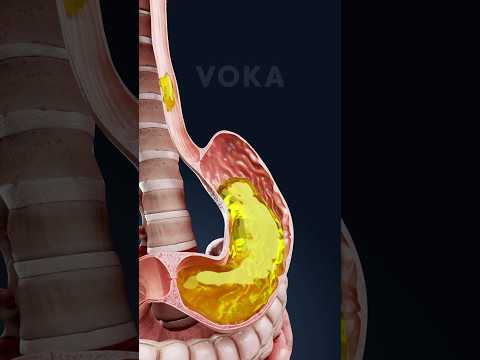 Revolutionizing Healthcare with Aspirating Vomit Solutions