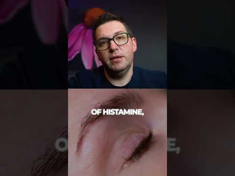 Olopatadine Hydrochloride: Revolutionizing Allergy Relief Today