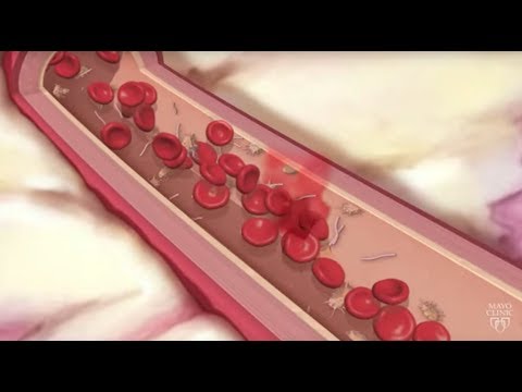 Empower Your Heart Health with Asa EC 81 MG Technology