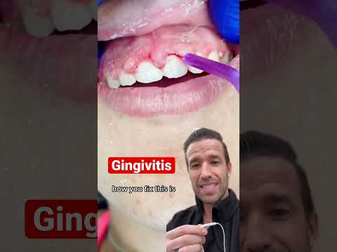 Soothe Gum Swelling Pain with Cutting-Edge Solutions