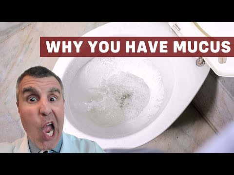 Understanding Mucus in Stool: Causes and Solutions Explained