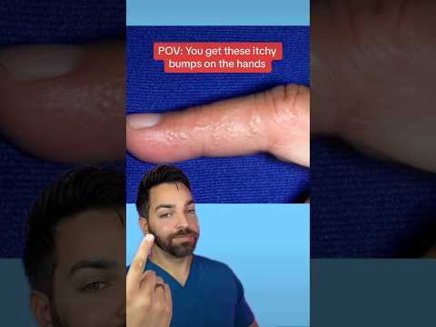 Itchy Face Solutions: Tech Innovations for Instant Relief