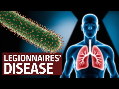 Legionnaires Bacteria: Protecting Your Health at Home