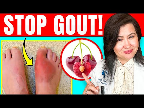 Tech-Driven Solutions for Natural Gout Relief at Home