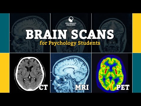 Unlocking the Secrets of a Normal Brain MRI Today
