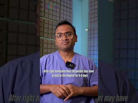 Revolutionizing Recovery: The Future of Right Hemicolectomy