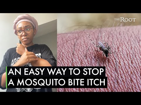 Instant Relief from Bug Bite Itching with Smart Solutions