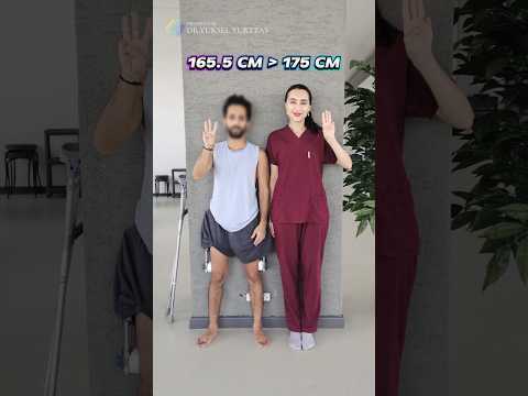 Revolutionize Your Mobility with Advanced Leg Extension Surgery