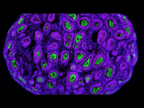Unlocking the Future of Spermatogonial Cell Technology