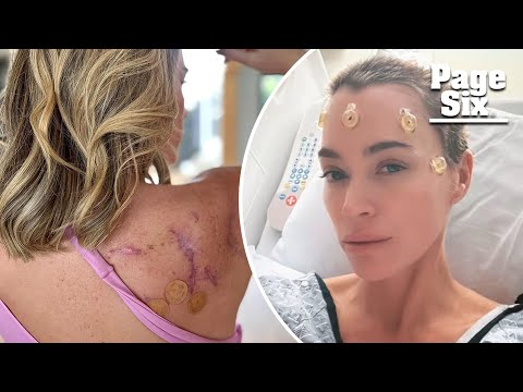 Teddi Mellencamp's Melanoma Journey: Tech Meets Awareness