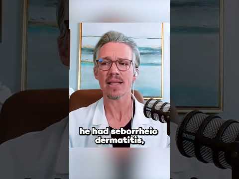 Conquer Hair Loss from Seborrheic Dermatitis with Innovation