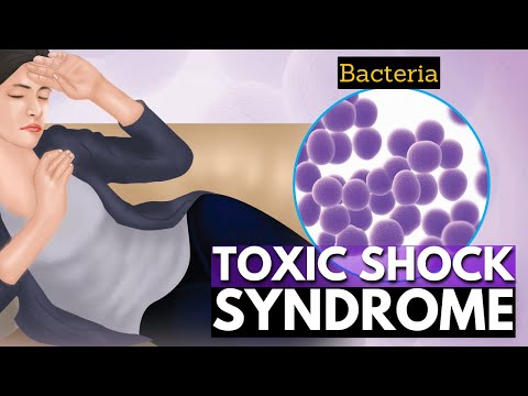 TSS Rash Uncovered: Tech Solutions for Health Awareness