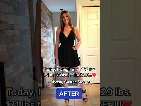 Transform Your Life with Innovative Sleeve Surgery Solutions