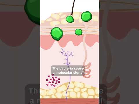 Lacy Rash Unveiled: Technology's Role in Skin Health