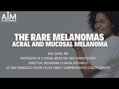 Innovative Breakthroughs in Mucosal Melanoma Treatment Solutions