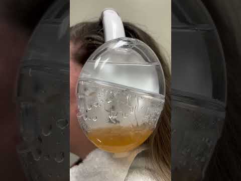 Revolutionize Your Ears with Smart Ear Cleaning Solutions