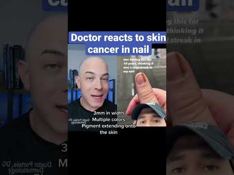 Nail Cancer: Innovations in Detection and Treatment Solutions