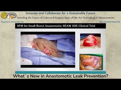 Innovative Solutions for Preventing Anastomotic Leaks