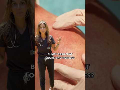 Beat the Itch: High-Tech Solutions for Armpit Rashes