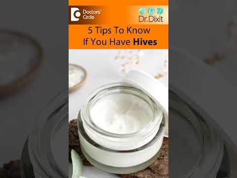 Relief at Your Fingertips: Cetirizine for Hives Management
