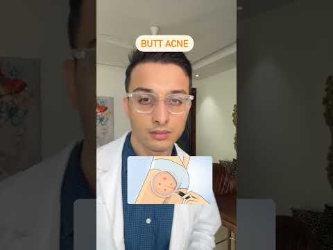 Red Bumps on Butt: Uncover Solutions for Comfort and Confidence