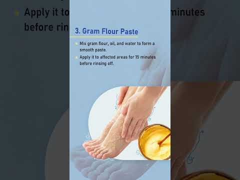 Relief for Itchy Hands and Feet During Pregnancy Made Simple
