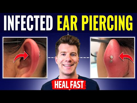 Smart Solutions for Managing Ear Piercing Swelling