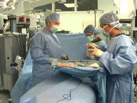 Revolutionary Lumpectomy: Precision Surgery for a Brighter Future