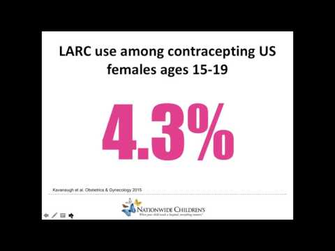 Embrace LARC: The Future of Smart Birth Control Solutions