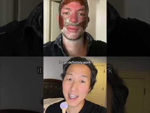 Revitalize Your Skin with Advanced Scar Tissue Solutions