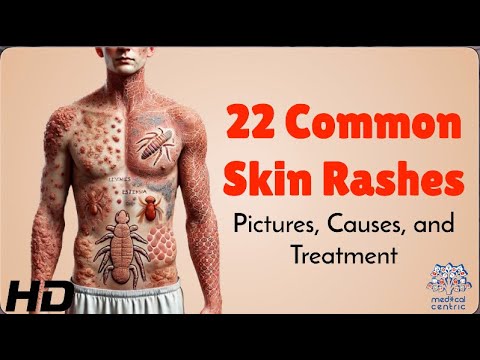 Unlock Relief: High-Tech Solutions for Skin Rashes