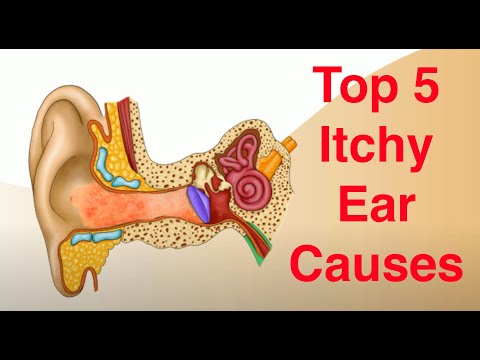 Soothe Your Itchy Ears with Innovative Remedies Today