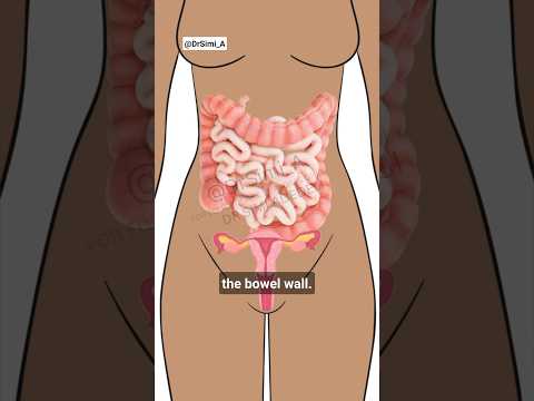 Relief for Constipation During Your Period: Tech Solutions Await