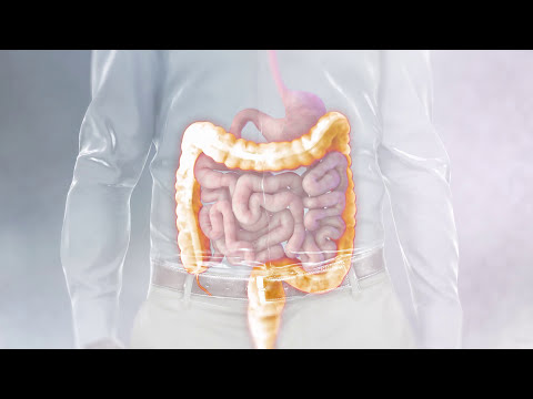 Revolutionizing Recovery: The Future of J Pouch Surgery