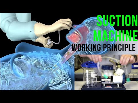 Suction Machines: Revolutionizing Efficiency in Technology