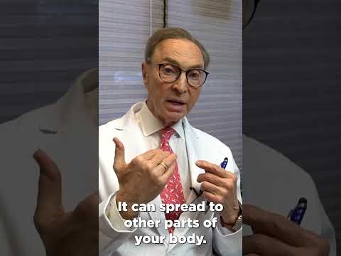 Tonsil Thrush Solutions: Innovative Relief at Your Fingertips