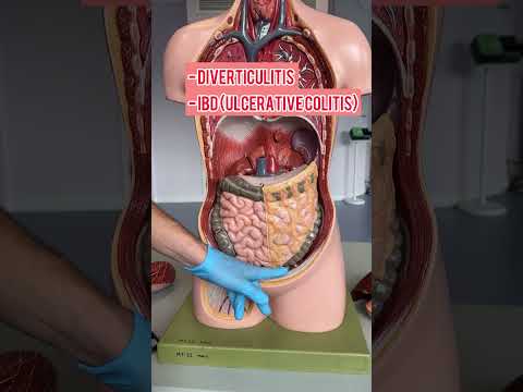 Understanding Lower Left Quadrant Pain: Tech Solutions Ahead