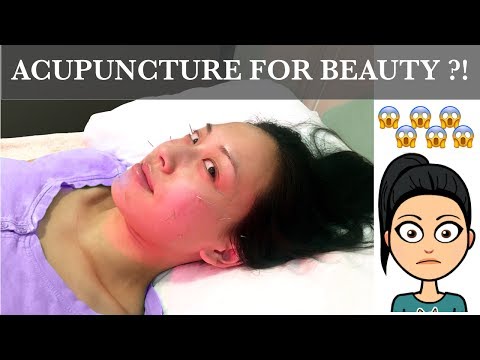 Revitalize Your Skin: The Tech of Facial Acupuncture