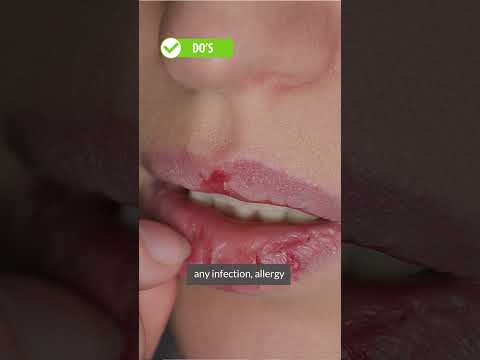Revitalize Dry Lip Skin with Innovative Hydration Solutions