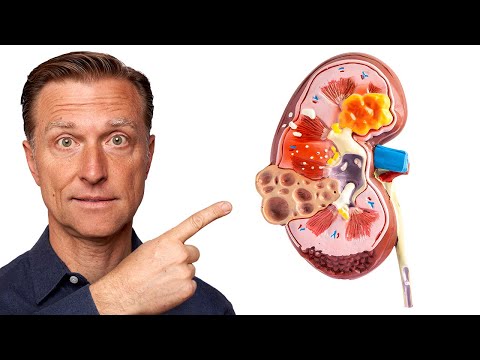 Revitalize Your Health with Advanced Kidney Supplements