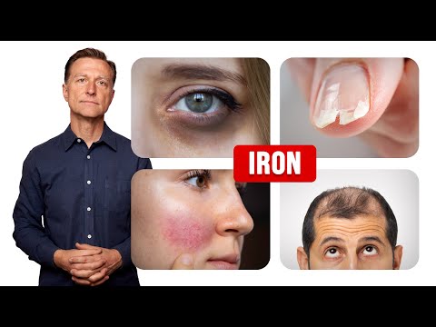 Boost Your Hair’s Strength with Iron Supplements Today