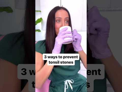 Revolutionizing Strep A Tonsil Treatments with Tech Innovations