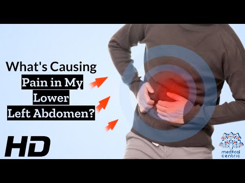 Understanding Left Side Stomach and Back Pain with Tech Solutions