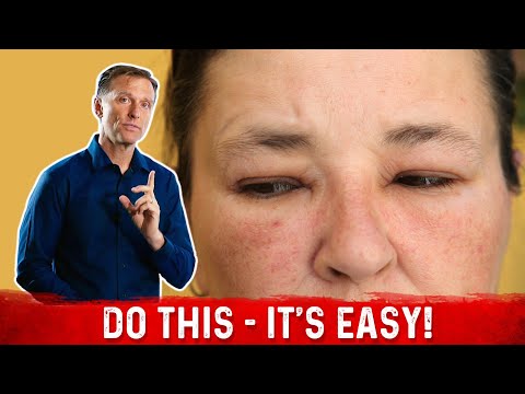 Morning Facial Swelling Solutions for a Fresh Start