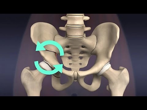 Transform Your Hip Health with Periacetabular Osteotomy Tech