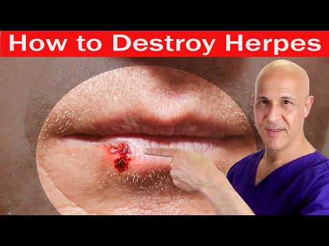 Effective Solutions for Body Herpes Rash Relief Today
