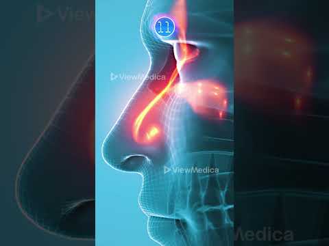 Anosmia is Loss of Smell: A Deep Dive into Its Tech Solutions