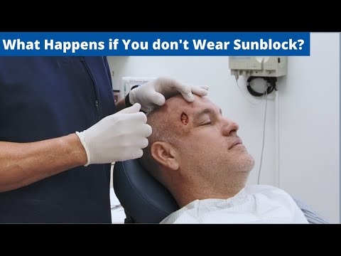 Smart Tech Solutions for Skin Melanoma Awareness and Care