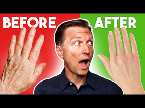 Revive Your Hands: Solutions for Dry Cracked Skin